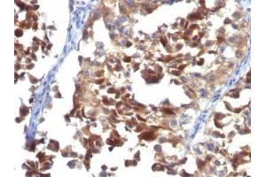 Image no. 2 for anti-CD63 (CD63) antibody (ABIN6187977) (CD63 Antikörper)