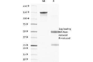 SDS-PAGE Analysis Purified CD104 Mouse Monoclonal Antibody (UMA9). (Integrin beta 4 Antikörper)