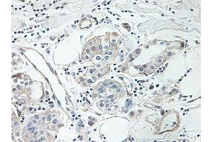 Image no. 4 for anti-Intercellular Adhesion Molecule 1 (ICAM1) antibody (ABIN465660) (ICAM1 Antikörper)