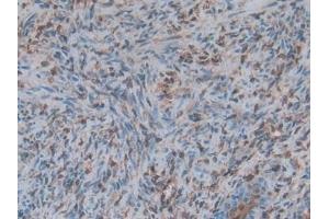 Immunohistochemistry (IHC) image for anti-S100 Calcium Binding Protein A6 (S100A6) (AA 1-89) antibody (ABIN7437005)