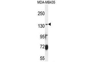 ABCC3 Antibody (Center) western blot analysis in MDA-MB435 cell line lysates (35 µg/lane). (ABCC3 Antikörper  (Middle Region))