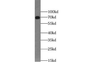 Western blot analysis of HepG2 cells subjected to SDS PAGE using VANGL2 antibody (1/1000). (VANGL2 Antikörper)