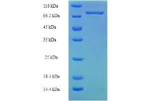 SDS-PAGE (SDS) image for Mixed Lineage Kinase Domain-Like (MLKL) (AA 1-471), (full length) protein (His-SUMO Tag) (ABIN5711680) (MLKL Protein (AA 1-471, full length) (His-SUMO Tag))