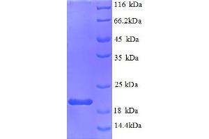 SDS-PAGE (SDS) image for Interleukin 1, beta (IL1B) (AA 119-268), (partial) protein (His tag) (ABIN5713080)