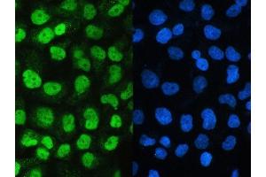 IF analysis of SAE2/UBA2 using anti-SAE2/UBA2 antibody (ABIN5692937).