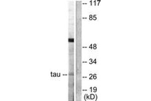 Western blot analysis of extracts from HeLa cells, using 14-3-3 thet/tau (Ab-232) Antibody. (14-3-3 theta Antikörper  (AA 196-245))