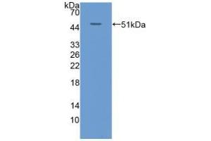 Western blot analysis of recombinant Human KRT20. (KRT20 Antikörper  (AA 9-424))