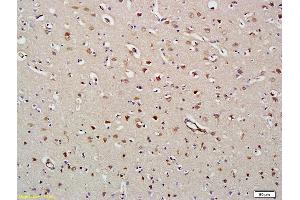 Formalin-fixed and paraffin embedded human brain labeled with Anti-HDAC8 Polyclonal Antibody, Unconjugated (ABIN681268) at 1:200 followed by conjugation to the secondary antibody and DAB staining (HDAC8 Antikörper  (AA 151-250))