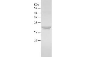 Western Blotting (WB) image for Fibroblast Growth Factor 4 (FGF4) (AA 25-206) protein (His tag) (ABIN7122942)