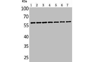 Western Blot analysis of customer's sample using ALPP/ALPPL2 Polyclonal Antibody. (PLAP Antikörper  (N-Term))