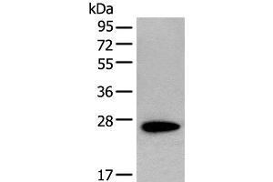 Western blot analysis of NIH/3T3 cell lysate using CD63 Polyclonal Antibody at dilution of 1:250 (CD63 Antikörper)
