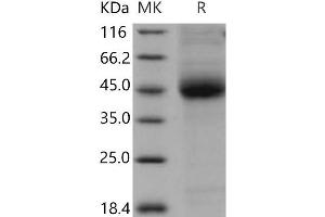 Western Blotting (WB) image for CD1d Molecule (CD1D) protein (His tag) (ABIN7320378) (CD1d Protein (His tag))