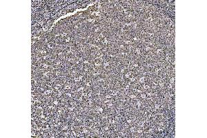 IHC analysis of HOXC4 using anti-HOXC4 antibody (ABIN7603059). (HOXC4 Antikörper  (Middle Region))