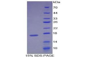 SDS-PAGE (SDS) image for Retinol Binding Protein 1, Cellular (RBP1) (AA 2-135) protein (His tag) (ABIN1980732)