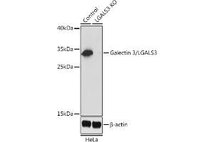 Western blot analysis of extracts from normal (control) and Galectin 3/Galectin 3/LG knockout (KO) HeLa cells, using Galectin 3/Galectin 3/LG antibody (ABIN6130437, ABIN6143158, ABIN6143159 and ABIN7101422) at 1:1000 dilution. (Galectin 3 Antikörper  (AA 1-250))