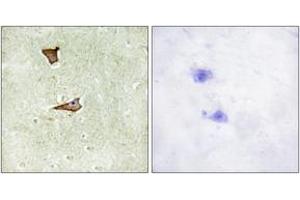 Immunohistochemistry analysis of paraffin-embedded human brain, using IGF2R (Phospho-Ser2409) Antibody. (IGF2R Antikörper  (pSer2409))