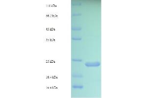 SDS-PAGE (SDS) image for Von Willebrand Factor A Domain Containing 5B2 (VWA5B2) (AA 781-862), (partial) protein (His-SUMO Tag) (ABIN5711517) (VWA5B2 Protein (AA 781-862, partial) (His-SUMO Tag))