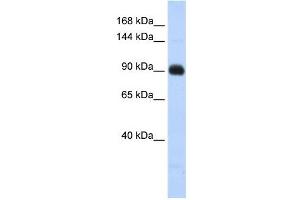 Matrilin 2 antibody used at 1 ug/ml to detect target protein. (MATN2 Antikörper  (Middle Region))
