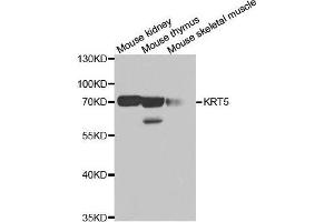 Western blot analysis of extracts of various cell lines, using KRT5 antibody. (Cytokeratin 5 Antikörper)