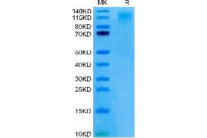 CD96 Protein (CD96) (Cys110Ser-Mutant) (His tag)