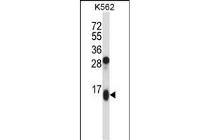 GUCA2A Antibody (Center) (ABIN657787 and ABIN2846761) western blot analysis in K562 cell line lysates (35 μg/lane).