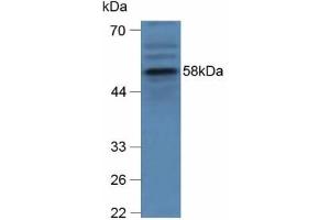Detection of GBA in Human hepG2 Cells using Polyclonal Antibody to Glucocerebrosidase (GBA) (GBA Antikörper  (AA 255-509))