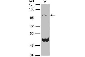 WB Image Sample(30 μg of whole cell lysate) A:Raji, 7. (NLRP3 Antikörper  (C-Term))
