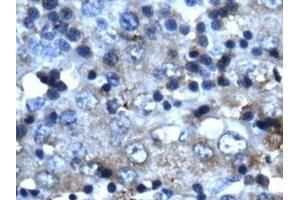 Image no. 1 for anti-Cyclin-Dependent Kinase 2 (CDK2) (C-Term) antibody (ABIN202994) (CDK2 Antikörper  (C-Term))