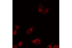 ABIN6276667 staining HeLa by IF/ICC. (FCGR2A Antikörper  (C-Term))