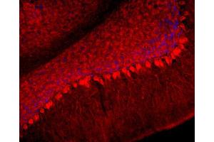 Immunohistochemistry (IHC) image for anti-Neurofilament, Light Polypeptide (NEFL) (AA 1-284) antibody (ABIN1742359)