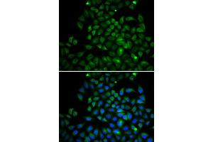 Immunofluorescence analysis of A549 cell using FABP4 antibody. (FABP4 Antikörper  (AA 1-132))
