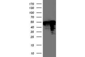 Western Blotting (WB) image for anti-T-Cell Acute Lymphocytic Leukemia 1 (TAL1) antibody (ABIN1501294) (TAL1 Antikörper)