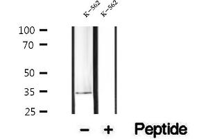 Western blot analysis of extracts of K-562 cells, using PDHB antibody. (PDHB Antikörper  (N-Term))