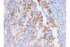 Immunohistochemistry (IHC) image for anti-Cadherin-16 (CDH16) (AA 371-507) antibody (ABIN6939023)