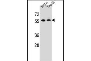 MGAT2 Antibody  (ABIN389038 and ABIN2839252) western blot analysis in MCF-7? (MGAT2 Antikörper  (C-Term))