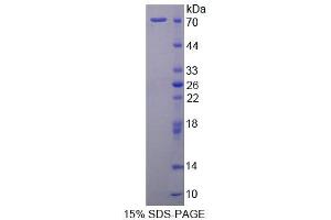 SDS-PAGE (SDS) image for Signal Transducing Adaptor Molecule (SH3 Domain and ITAM Motif) 2 (STAM2) (AA 1-377) protein (His tag,GST tag) (ABIN4989604) (STAM2 Protein (AA 1-377) (His tag,GST tag))
