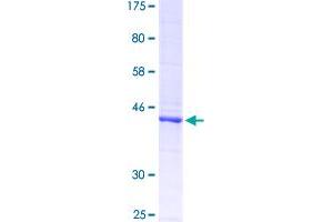 Image no. 1 for Protein tyrosine Phosphatase, Receptor Type, C (PTPRC) (AA 390-570) protein (GST tag) (ABIN1316863) (CD45 Protein (AA 390-570) (GST tag))