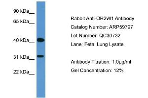 WB Suggested Anti-OR2W1  Antibody Titration: 0.