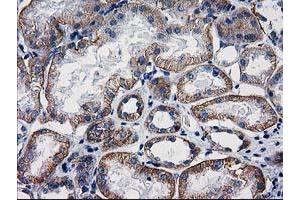Image no. 2 for anti-Catenin (Cadherin-Associated Protein), beta 1, 88kDa (CTNNB1) antibody (ABIN1496890) (CTNNB1 Antikörper)