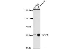 Western blot analysis of extracts of various cell lines using RBM46 Polyclonal Antibody at dilution of 1:1000. (RBM46 Antikörper)
