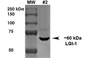 Western Blot analysis of Rat Brain Membrane showing detection of ~60 kDa LGI1 protein using Mouse Anti-LGI1 Monoclonal Antibody, Clone S283-7 .