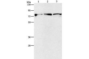 Western Blot analysis of Mouse brain and Human fetal brain tissue, Human brain malignant glioma tissue using KIF3A Polyclonal Antibody at dilution of 1:500 (KIF3A Antikörper)