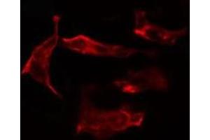 ABIN6266972 staining HT29 cells by IF/ICC. (CYP2J2 Antikörper  (Internal Region))