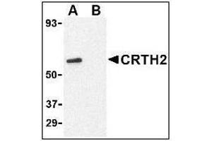 Western blot analysis of CRTH2 in Jurkat cell lysate with at 1 µg/ml in (A) the absence and (B) presence of blocking peptide. (Prostaglandin D2 Receptor 2 (PTGDR2) (N-Term) Antikörper)