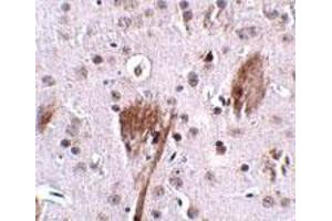 Immunohistochemical staining of mouse brain tissue with 2. (SPG11 Antikörper  (C-Term))
