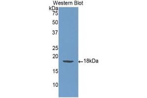Detection of Recombinant SELP, Human using Monoclonal Antibody to P-Selectin (SELP) (P-Selectin Antikörper  (AA 198-432))