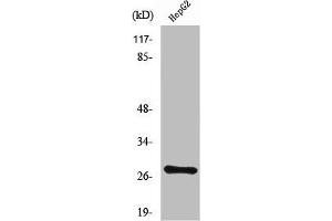 Western Blot analysis of LOVO cells using NPDC-1 Polyclonal Antibody (NPDC1 Antikörper  (Internal Region))