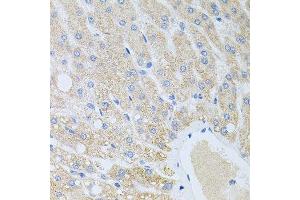 Immunohistochemistry of paraffin-embedded human liver injury using DLK1 antibody.