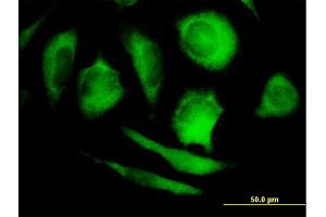 Immunofluorescence of purified MaxPab antibody to PPP5C on HeLa cell.