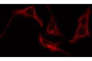 ABIN6276205 staining Hela cells by IF/ICC. (Prostacyclin Receptor Antikörper  (Internal Region))